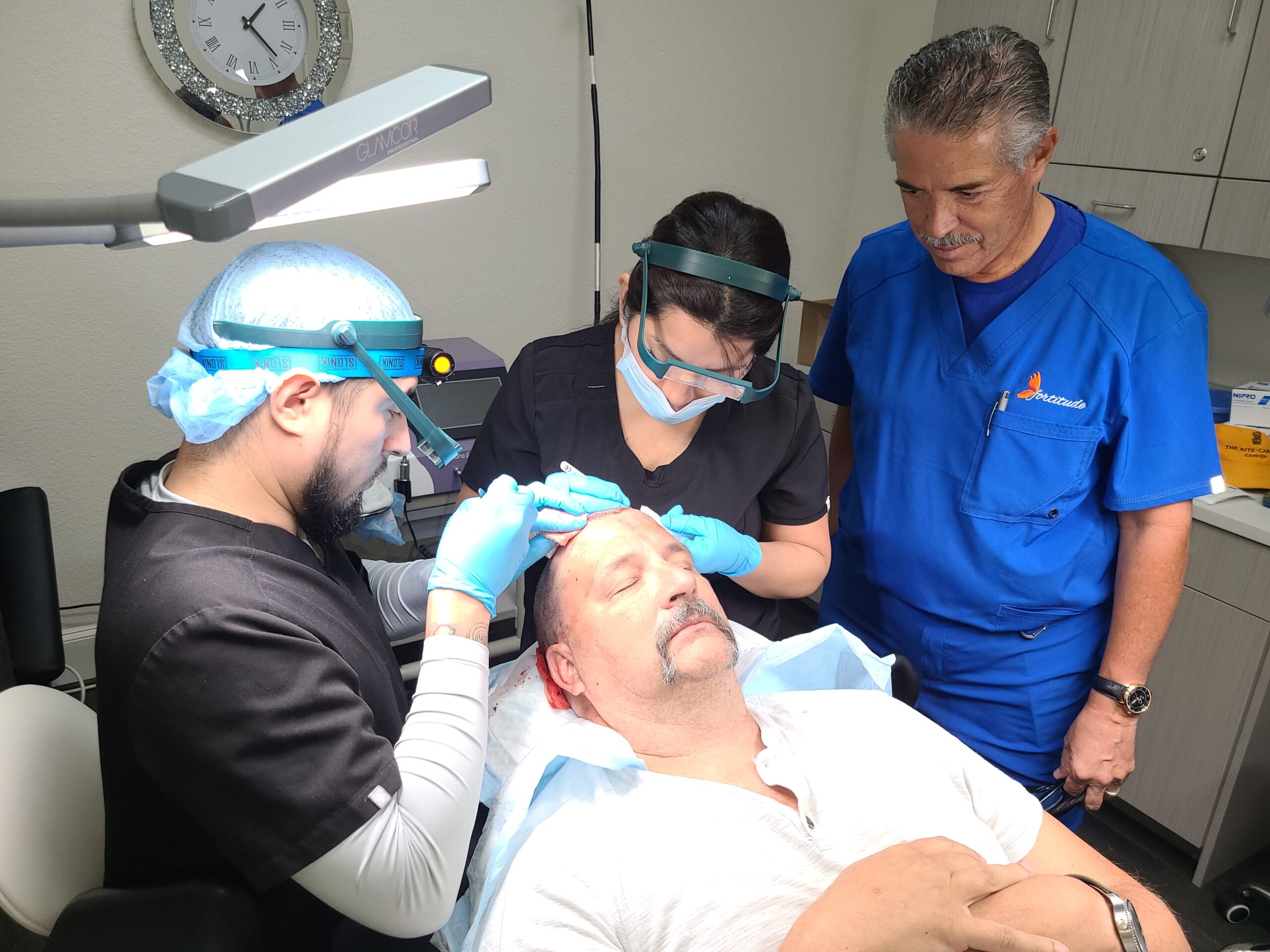 FUE Hair Transplant