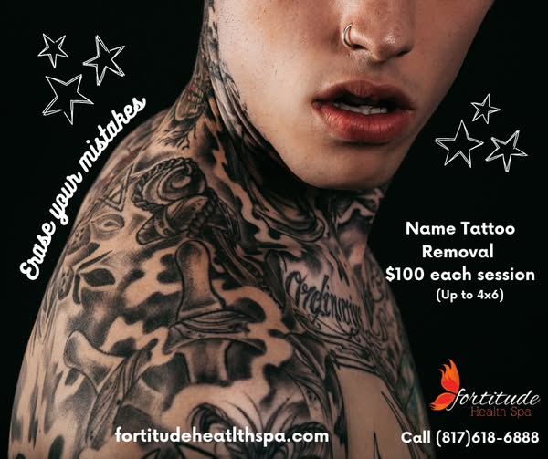 Tattoo Removal Specials