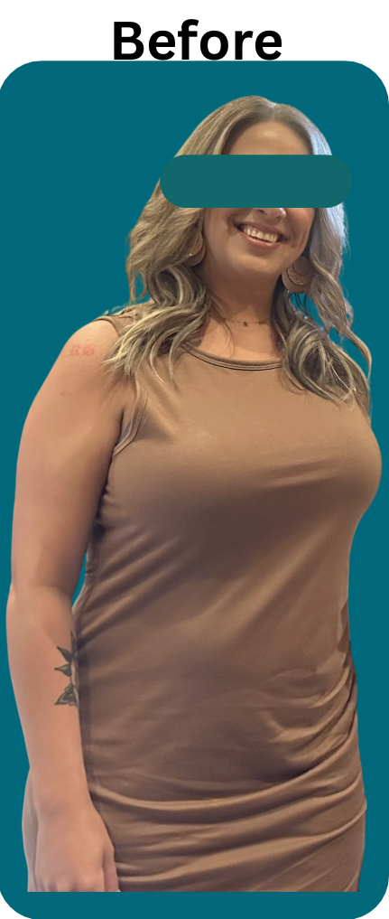 nBefore-Weight loss injections